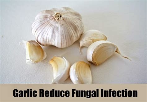 5 Herbal Remedies For Fungal Infection Mzizi Mkavu