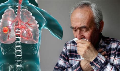 Lung Cancer Symptoms The Major Sign In Your Body To Look Out For