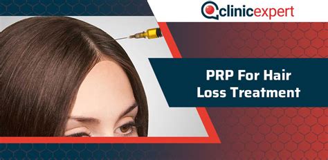 Prp For Hair Loss Treatment Clinicexpert