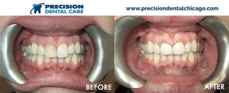 We are also a proud member. Precision Dental Care | The Best Dentists in Chicago IL