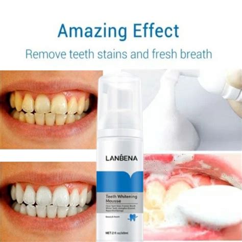 Teeth Stain Cleaning Whitening Mousse Lanbena 100 Original Shopee Malaysia