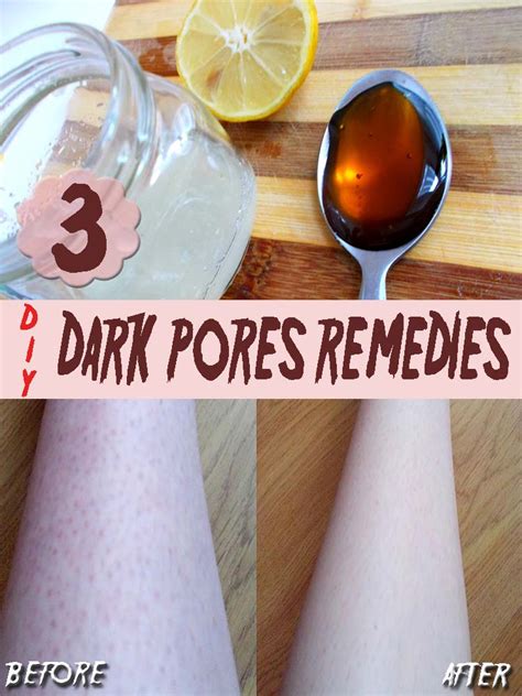 3 Homemade Remedies For Dark Pores Homemadelifeproject