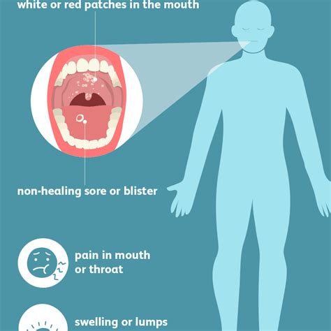 Oral Cancer Signs Symptoms And Complications