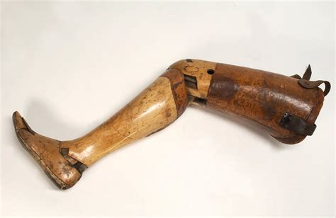 Artificial Left Leg With Thigh Socket For Amputation Above The Knee