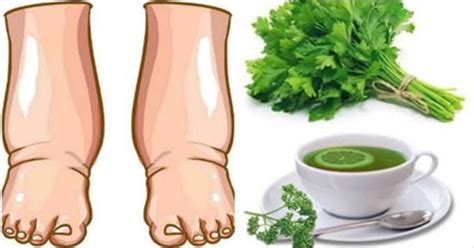 This Powerful Homemade Tea Will Cure Swollen Legs In Few Days Healthy