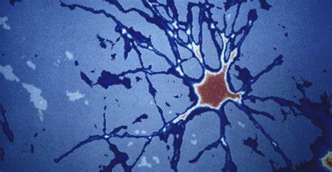 Creatures to human models Indian researchers question new methodology in Alzheimer's exploration