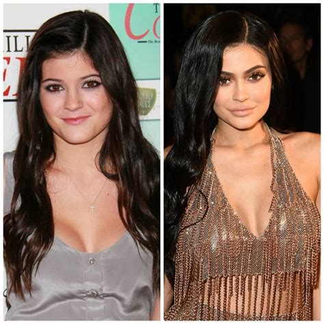 After surgery, subscribers in the comments the photo before and after shows that kylie jenner got a nose job. Kylie Jenner Before and After Plastic Surgery Photos ...