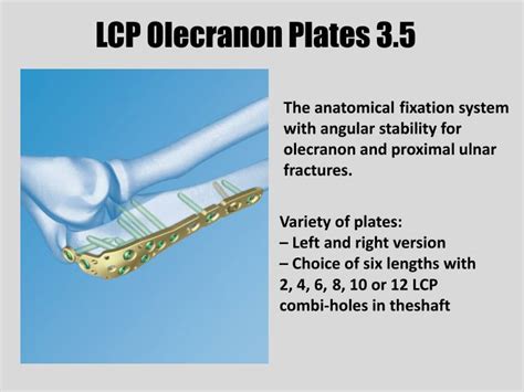 Ppt Lcp Olecranon Plates 35 Powerpoint Presentation Free Download