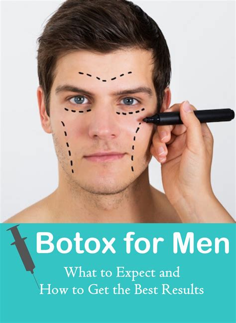 The Ultimate Guide To Botox For Men What You Need To Know Healthy
