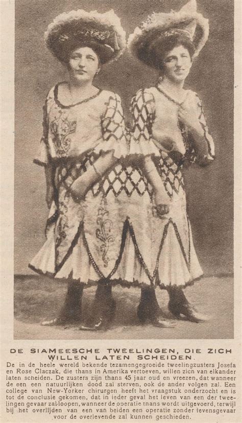 Siamese Twin Josefa En Rosa Flickr Photo Sharing Old Circus Vintage Circus Creepy Old