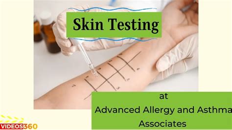 Skin Testing Done At Advanced Allergy And Asthma Associates Explained