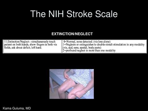 Ppt Stroke Systems And Stroke Scales In The Management