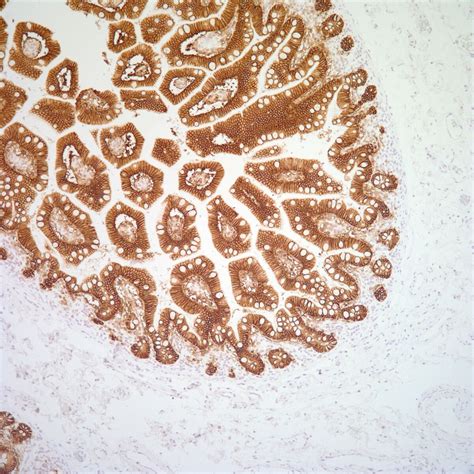 Moc 31 Pathology Resident Wiki Fandom