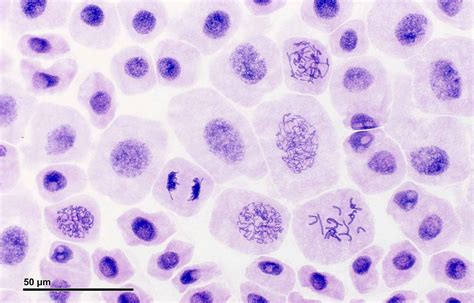 Check spelling or type a new query. Mitosis Phases in Onion Root Tip Cells | Tuva