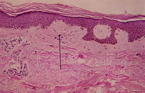 Dermatopatologia Agosto 2018