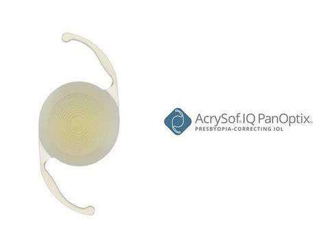 Panoptix Trifocal Intraocular Lens Surpasses One Million Implants Worldwide Theprint