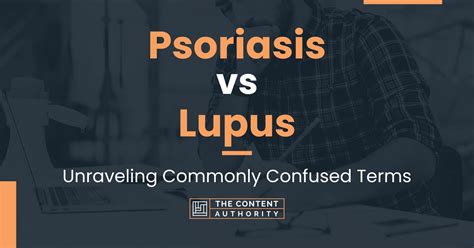 Psoriasis Vs Lupus Unraveling Commonly Confused Terms