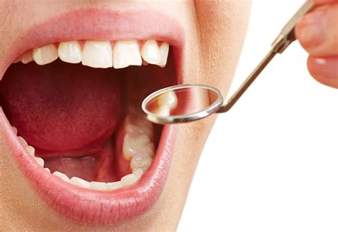クリーニング｜日吉の歯医者「矢島歯科医院」舌トレーニングで口呼吸から鼻呼吸へ