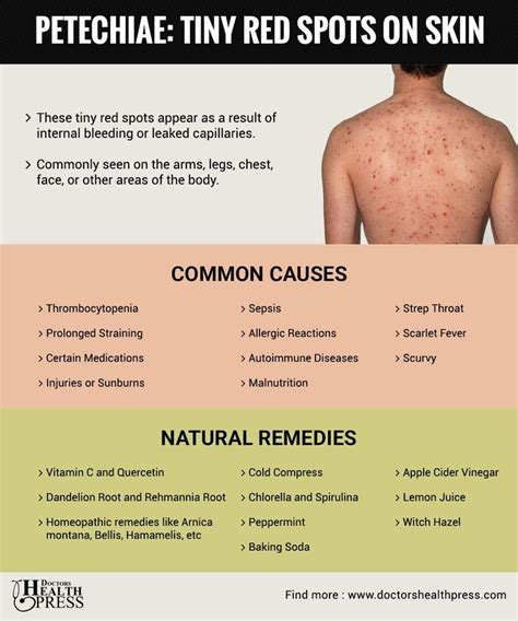 Information on hantaviruses, hantavirus pulmonary syndrome (hps), and hemorrhagic fever with renal syndrome (hfrs). What Are These Tiny Red Spots On My Skin? Causes ...