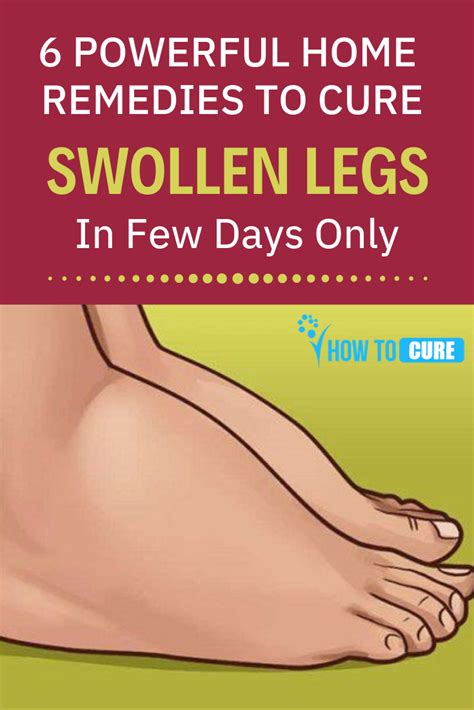 6 Effective Natural Ways To Treat Swollen Legs Howtocure Swollen