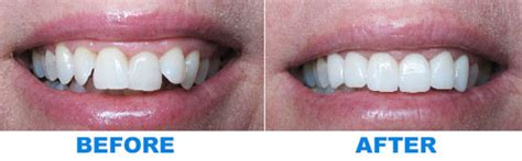 Check spelling or type a new query. Orthodontics in Chester, NY | InvisalignDr. Jacquie