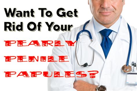 1 Get Rid Of Pearly Penile Papules Fast Youtube