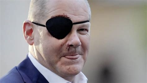 What Happened To Olaf Scholz Eye Patch Injury Accident And Nose Scar