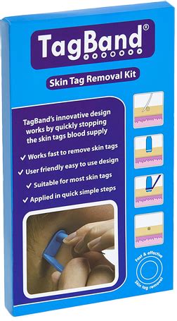 Once a doctor confirms that the growth is benign, no further action is usually necessary. TagBand & Micro TagBand Skin Tag Removal Kit | Skin tag ...