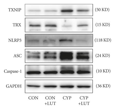 LUT Inhibits The TXNIP NLRP Pathway In CYP Induced Cystitis A The Download Scientific