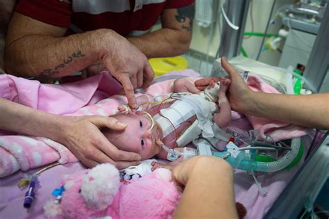 Video Miracle Baby Vanellope Survives After Being Born With Heart