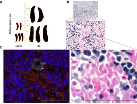Frontiers Babesia Microti Infection Changes Host Spleen Architecture