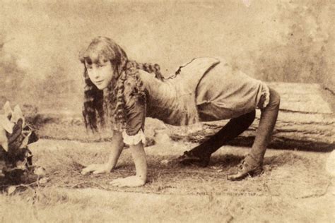 Unbelievable Photos Of Freak Show Performers From The Past