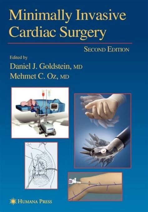 Minimally Invasive Cardiac Surgery 9781617374005 Boeken