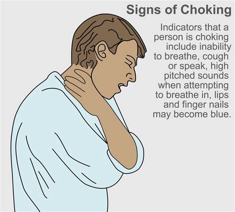 Signs Of Choking Poster Print By Gwen Shockeyscience Source 24 X 18