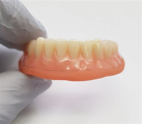 What Is The Best Soft Liner For Dentures The Soft Liner Alternative