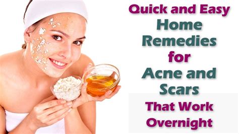 Quick Easy Home Remedies For Acne And Scars That Work Overnight Youtube