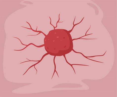 Cancer Cell Illustration Illustrations Royalty Free Vector Graphics