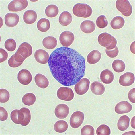 Immature Granulocytes Blood Film Medschool