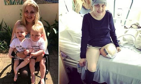 devastated mum loses leg after being diagnosed with rare cancer daily mail online