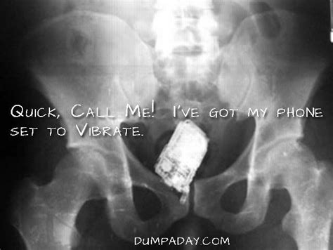 Dump A Day Amazing X Rays Of Random Objects Inserted Into Bizarre Places Pics X Ray