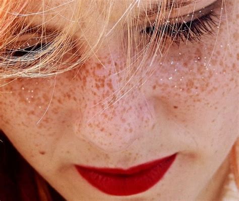 The Best How To Get Rid Of Freckles On Lips Ideas