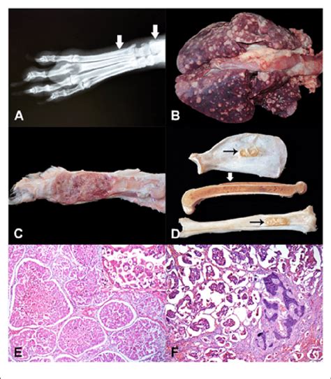 Metastatic Prostatic Carcinoma Resembling An Osteosarcoma In A Dog