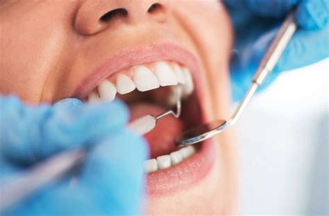 📍 ¿qué Es Un Curetaje Dental Clínica Dental Veracruz En Móstoles