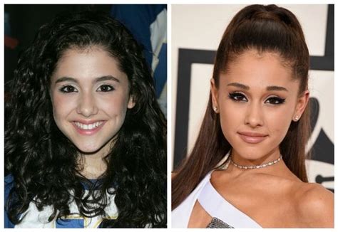 Ariana Grande Plastic Surgery And Nose Jobs On Pinterest