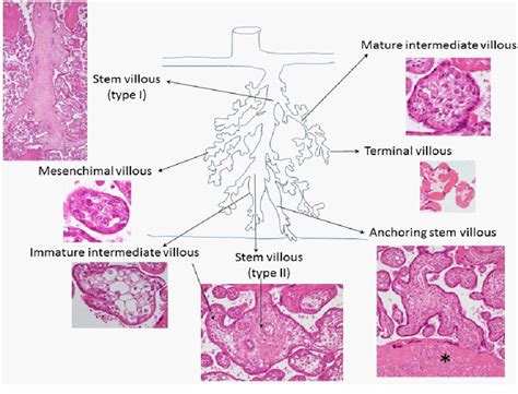 Figure 5 From Histology Of Human Placenta Semantic Scholar