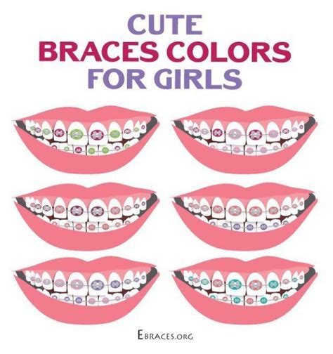 braces colors for girls braces colors cute braces dental braces colors