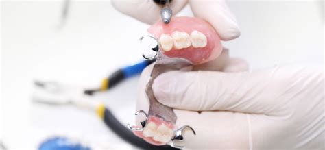 See 4 authoritative translations of consent in spanish with example sentences, conjugations and audio pronunciations. Partial Dentures - Burnside Dental Centre