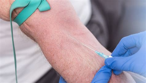 Peripheral Iv Therapy For Nurses Frontline