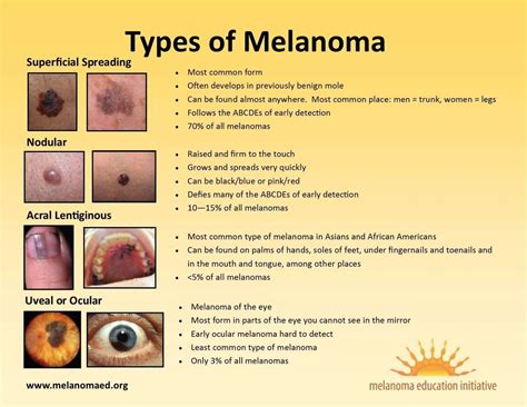 What Are The Different Types Of Melanoma