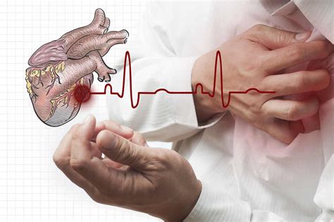 Enfermedades Del Corazón Causas Tipos Tratamiento Y Prevención